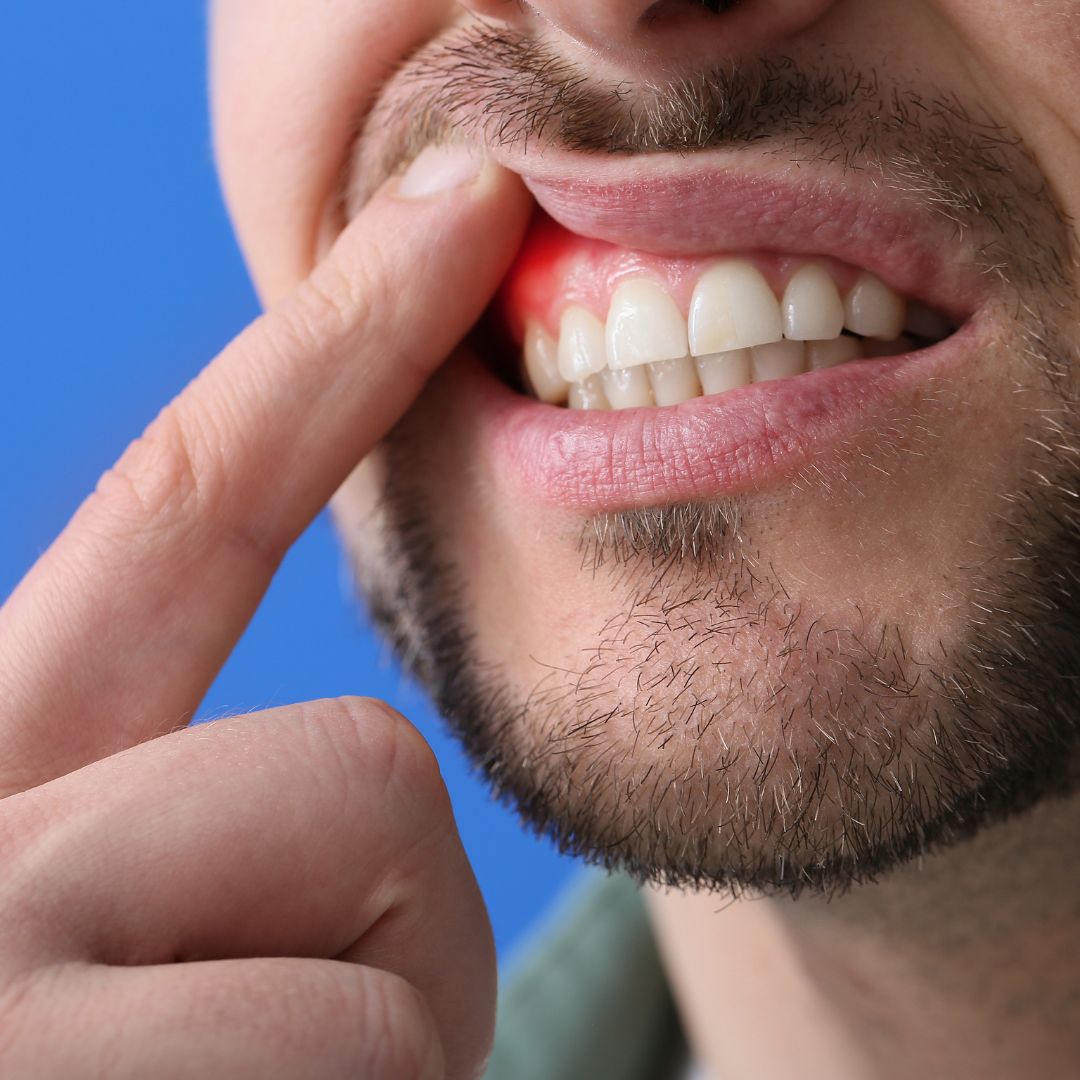 gum disease and dentures