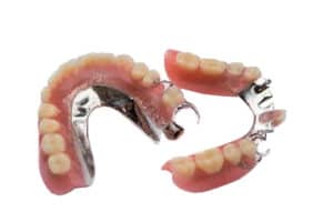 metal cast partial denture