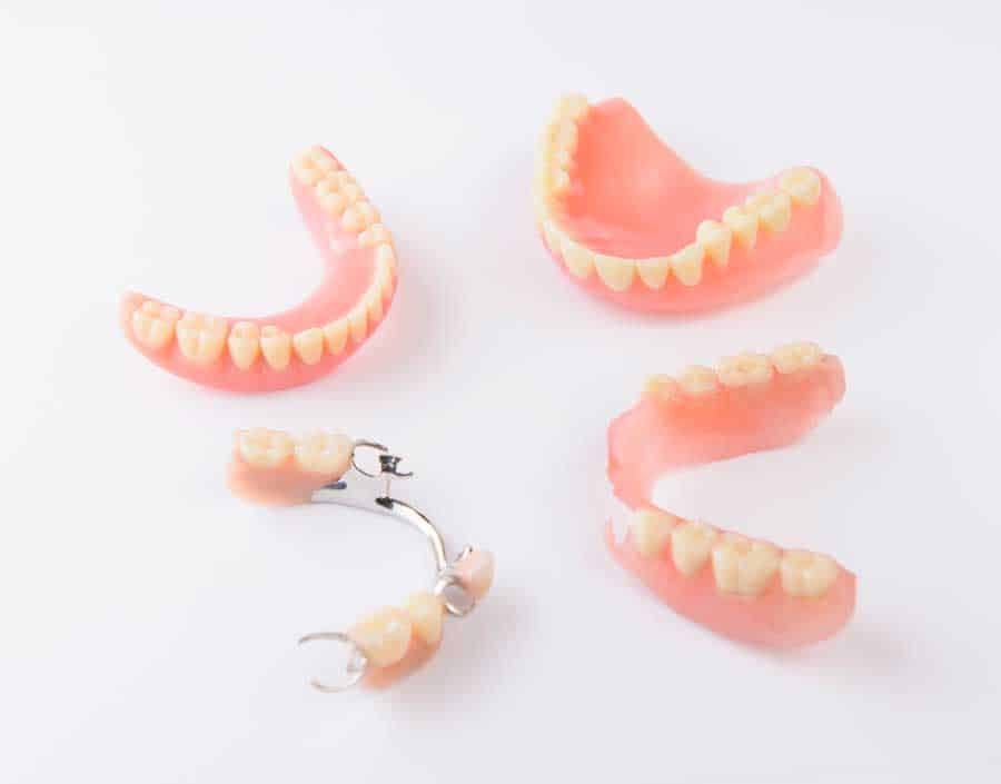 Removable-partial-dentures - Premier Dentures