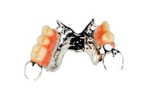cast metal partial denture